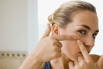 Home Remedies for Acne
